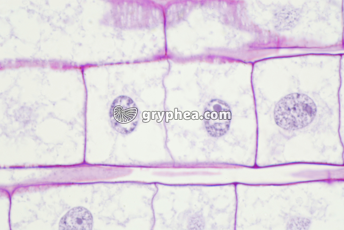 Mitose dans une racine de Blé (fin de télophase) x200  - gryphea.com